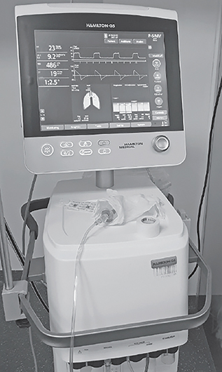 傳統呼吸器（資料來源為維基共享資源）。天下雜誌提供