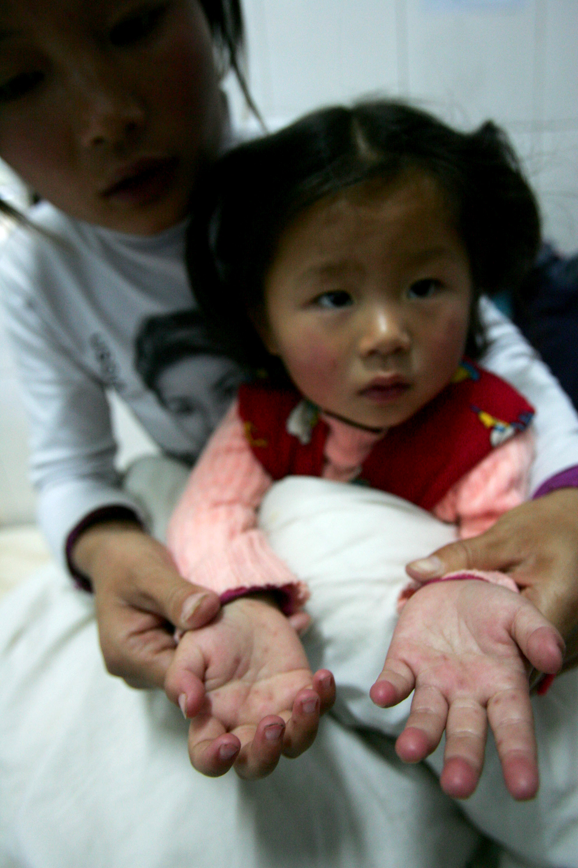 中国当局3月27日才首次对外披露，2008年全国有48.9万儿童患手足口病，126人死亡。